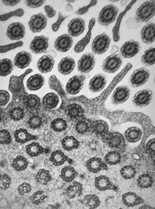 M,22y. | normal bronchial epithelium